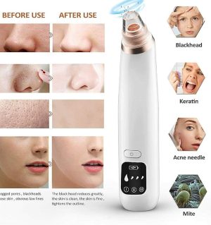 Electric Blackhead Remover – Deep Pore Vacuum Acne Cleaner for Nose & Facial Care