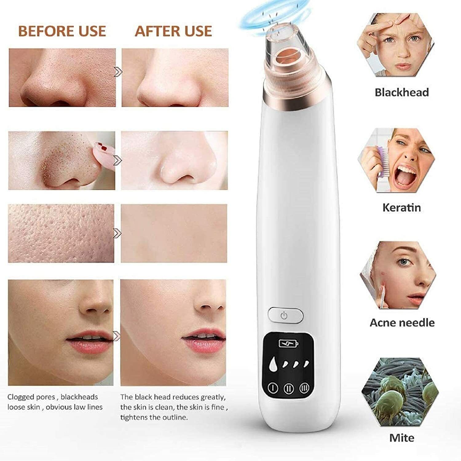Electric Blackhead Remover – Deep Pore Vacuum Acne Cleaner for Nose & Facial Care